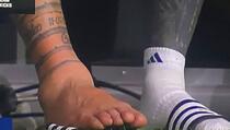 Messijev zglob nakon povrede izgleda potpuno nevjerovatno, šokirao je sve kada je skinuo štucne