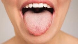 Ako vaš jezik izgleda ovako, ne biste trebali piti kafu